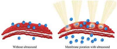 Nano-Enhanced Drug Delivery and Therapeutic Ultrasound for Cancer Treatment and Beyond